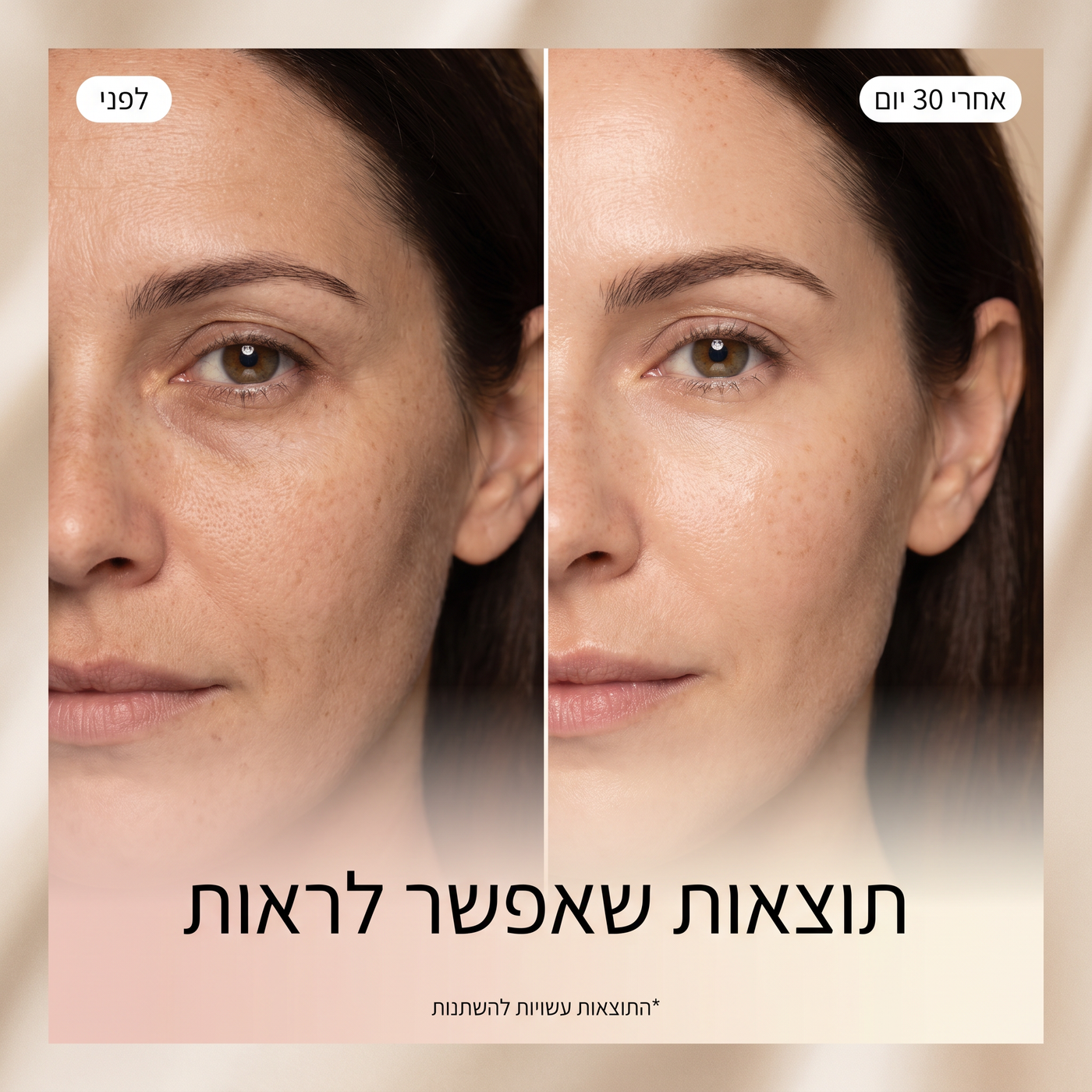 RIVORA ONE — מראה קרוב של ראש הטיפול והגימור המתכתי