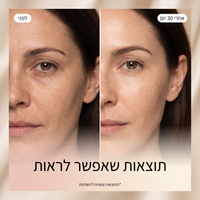 RIVORA ONE — מראה קרוב של ראש הטיפול והגימור המתכתי